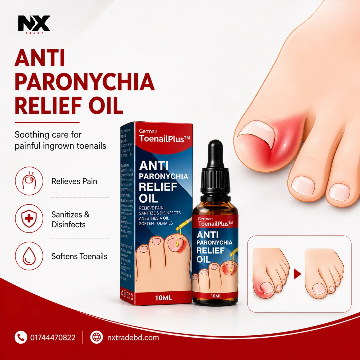 German ToenailPlus™ Anti Paronychia Relief Oil - Image 2