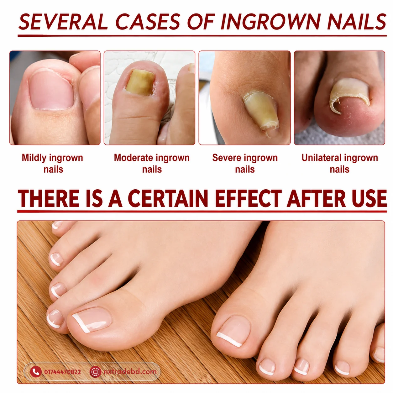 German ToenailPlus™ Anti Paronychia Relief Oil - Image 4